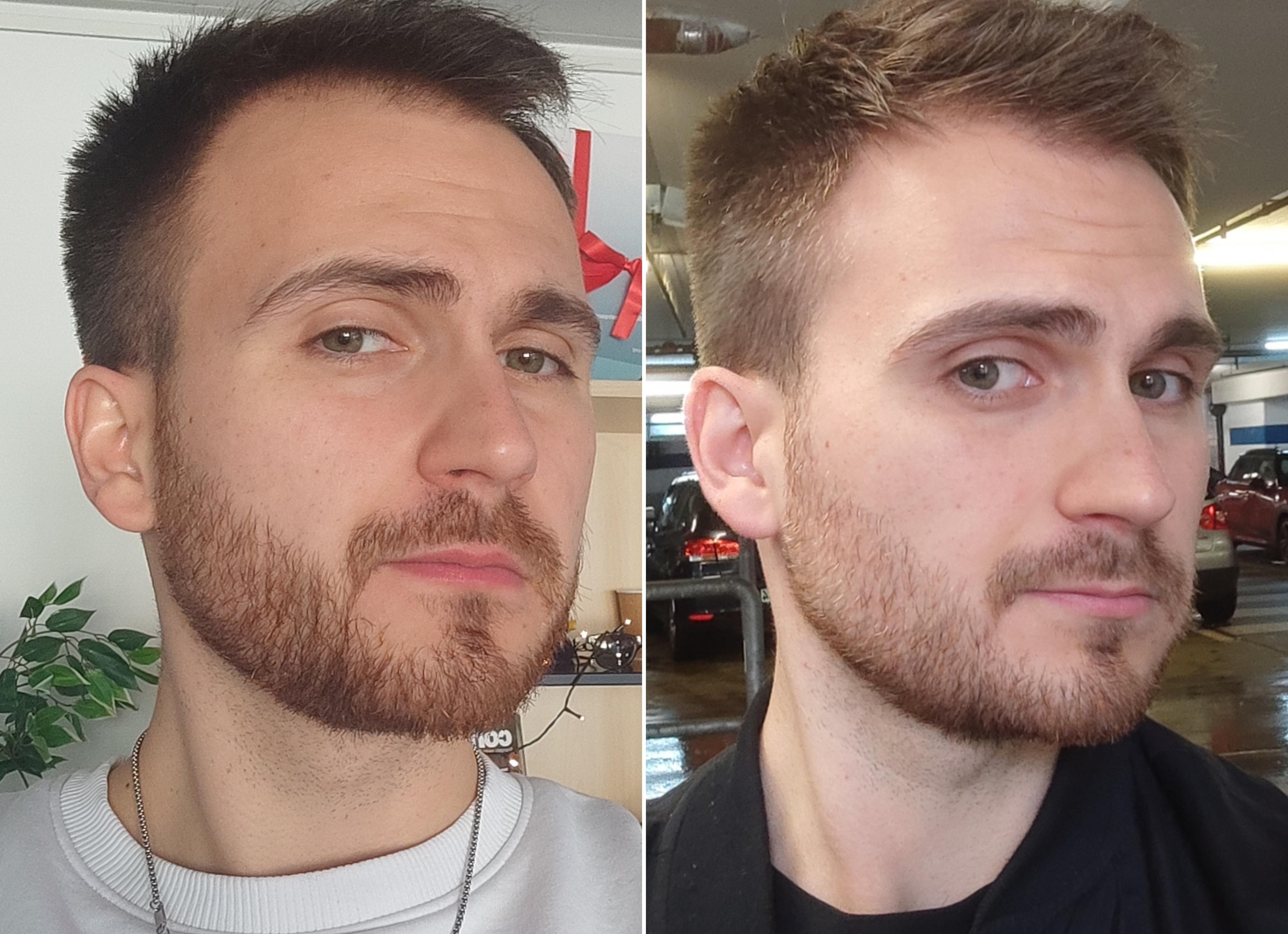 Короткая борода